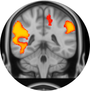 Functional MRI (fMRI) of the brain